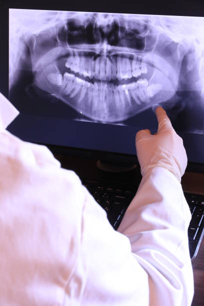 Best Emergency Dental Care for Broken or Chipped Teeth in Reedurban, OH